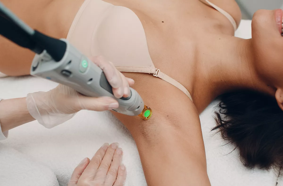 Epilation au laser d'une aisselle