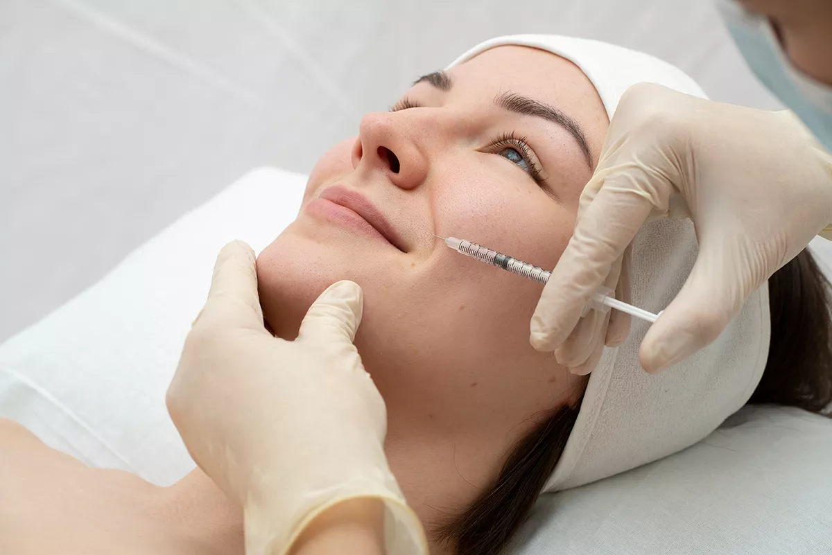 Injection d'acide hyaluronique dans les sillons nasogéniens