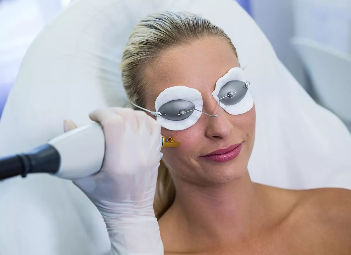 Traitement des taches pigmentaires du visage au laser