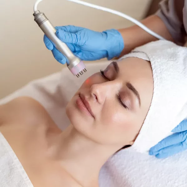 Image d'illustration d'un traitement du visage au laser