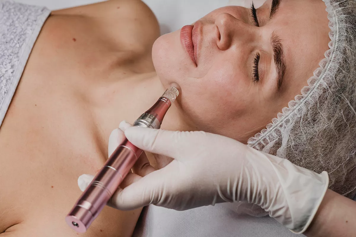 Séance de microneedling du visage