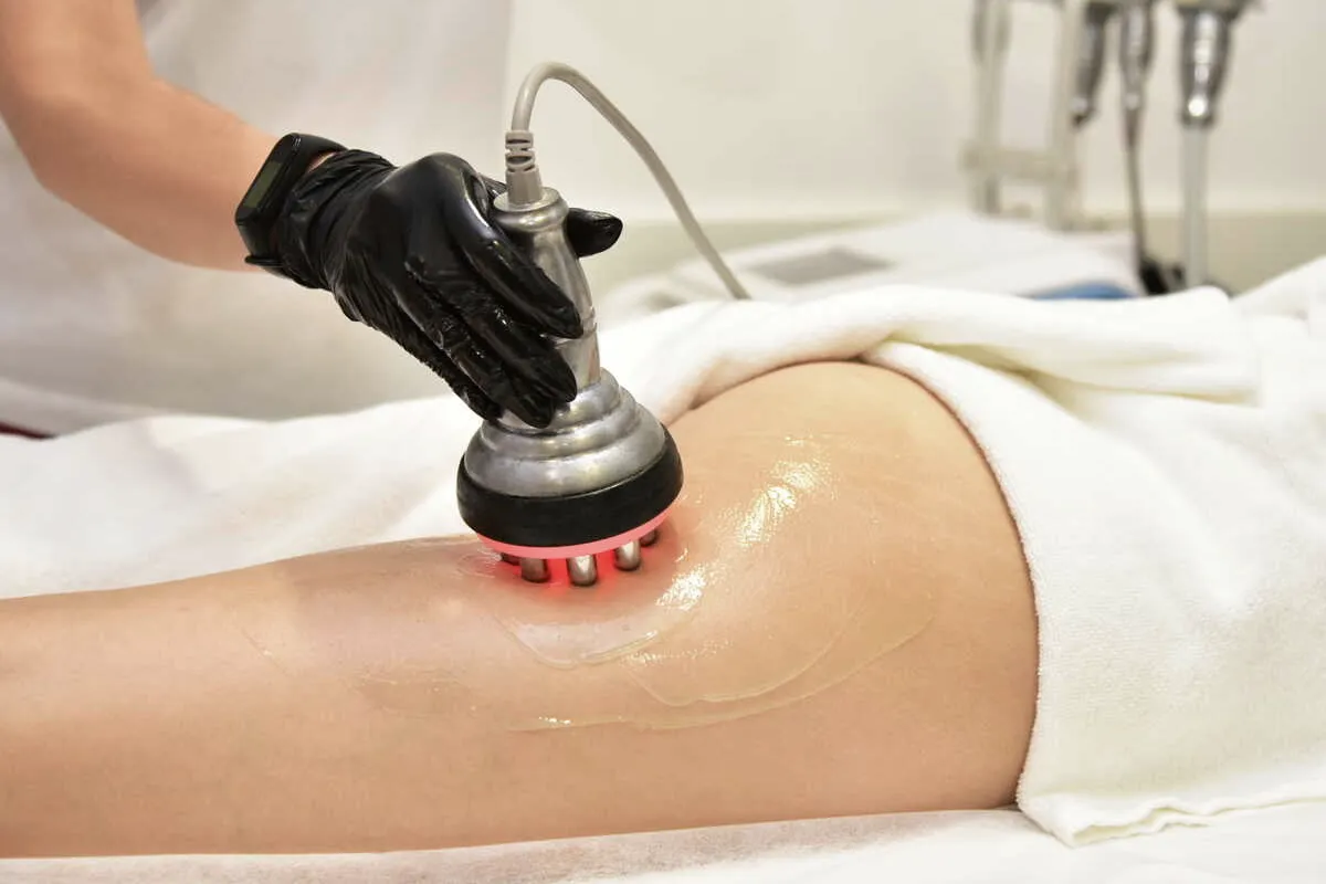 Lipocavitation du haut des cuisses